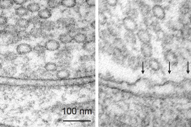 Hippocampal Neurons. Micrographs courtesy of Dr. Shigeki Watanabe, Johns Hopkins University