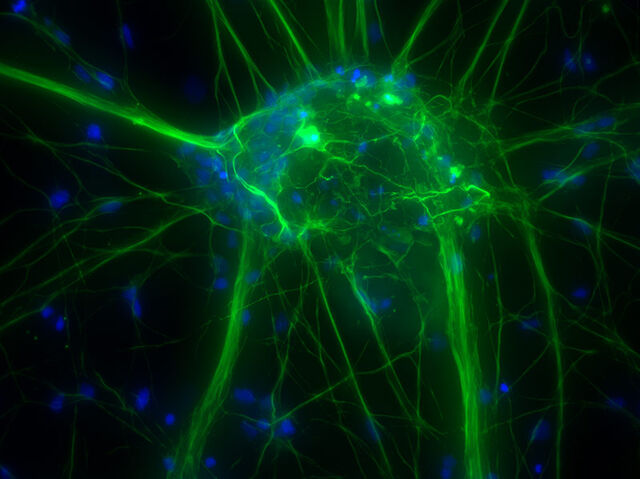Kultivierte kortikale Nervenzellen (Original-Rohdaten)