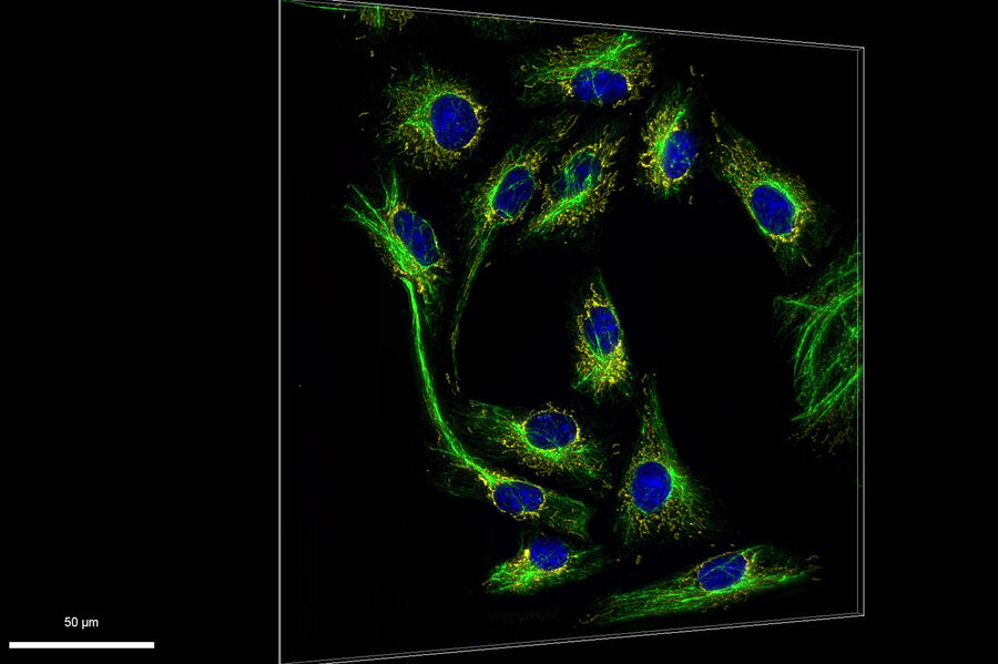 Cultured VERO cells - THUNDER Imager 3D Cell Culture