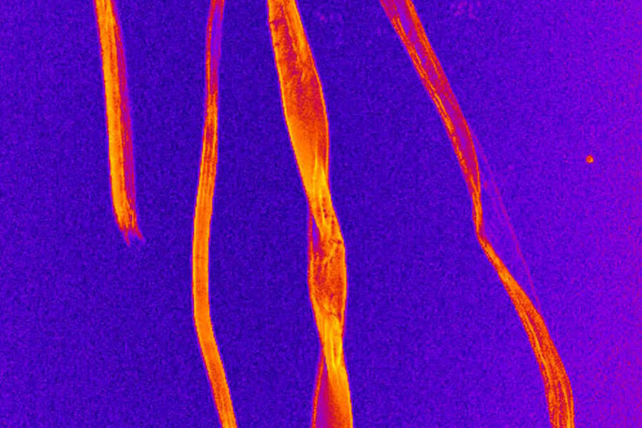 Figure 3: CARS image of cellulose fibers. The fibers are visualized through the C–H vibrations of the polyglucan chains in cellulose.