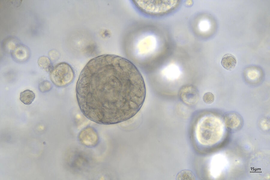 Figure 3: 40x magnification of organoids cluster taken on Mateo TL.Cell type: esophageal squamous carcinoma; scale  bar 15µm. 