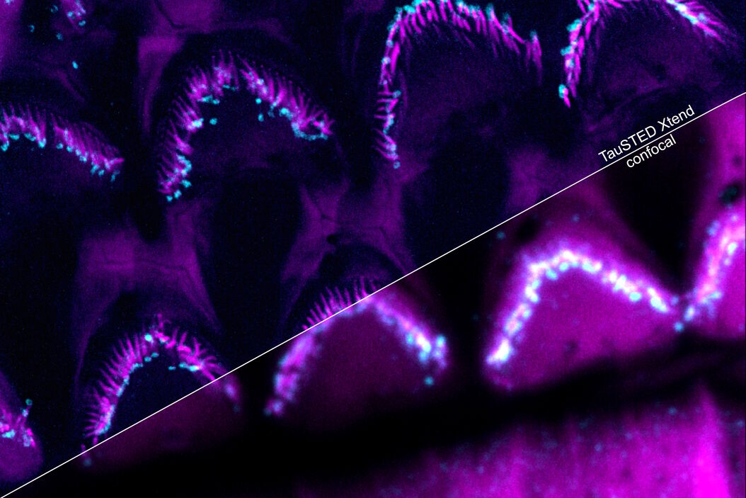 Multicolor fixed STED image. Inner ear section, mouse, TauSTED Xtend 589 on AF488 and TauSTED Xtend 775 on AF633-Phalloidin. Sample courtesy of Dennis Derstrof, Klinik für Hals-, Nasen und Ohrenheilkunde, Universität Marburg & Prof. Dr. Dominik Oliver aus dem Institut für Physiologie und Pathophysiologie, Abteilung für Neurophysiologie, Universität Marburg. Inner_ear_section_mouse_multicolor_fixed_TauSTED_Xtend.jpg