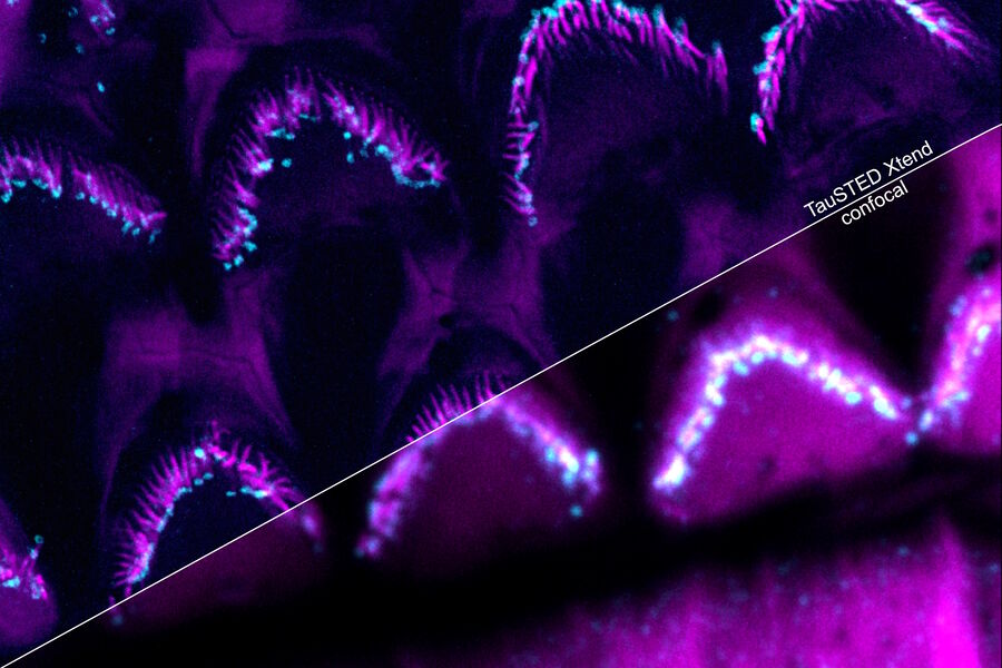 Fig 3: Multicolor fixed STED image. Inner ear section, mouse, TauSTED Xtend 589 on AF488 and TauSTED Xtend 775 on AF633-Phalloidin. Sample courtesy of Dennis Derstrof, Klinik für Hals-, Nasen und Ohrenheilkunde, Universität Marburg & Prof. Dr. Dominik Oliver aus dem Institut für Physiologie und Pathophysiologie, Abteilung für Neurophysiologie, Universität Marburg.