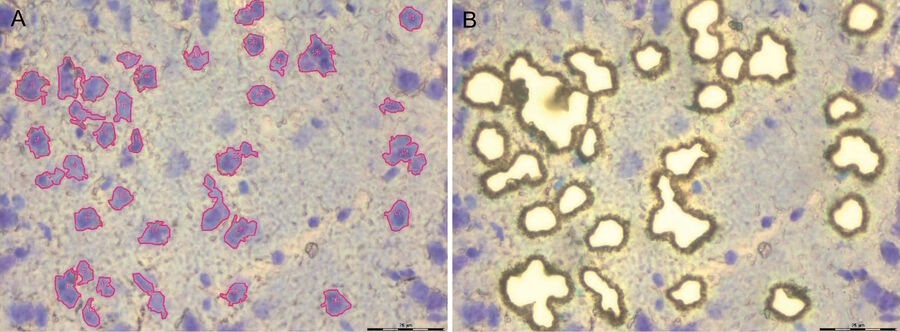 Laser Microdissection