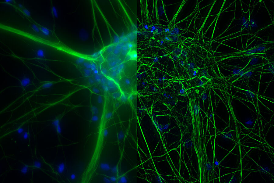 Cultured Cortical Neurons - THUNDER Imager 3D Cell Culture