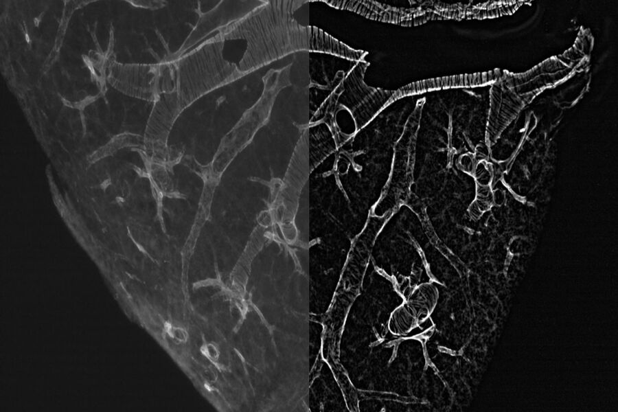 Smooth Muscle - THUNDER Imager Model Organism