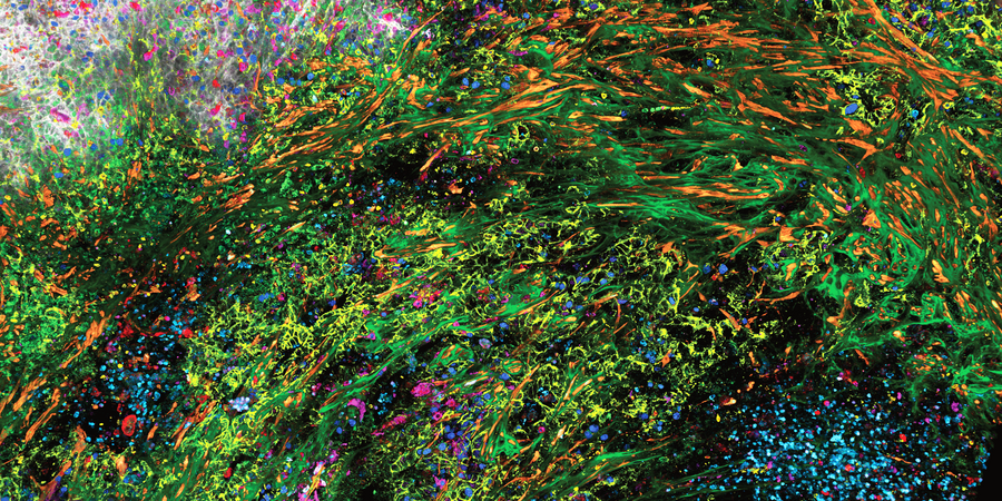 3D high-plex imaging in cancer immunology. Overview of a pancreatic tumor section in mouse model, labeled with 15 markers and imaged in one go using STELLARIS with SpectraPlex. (https://www.nature.com/articles/d42473-024-00260-7)