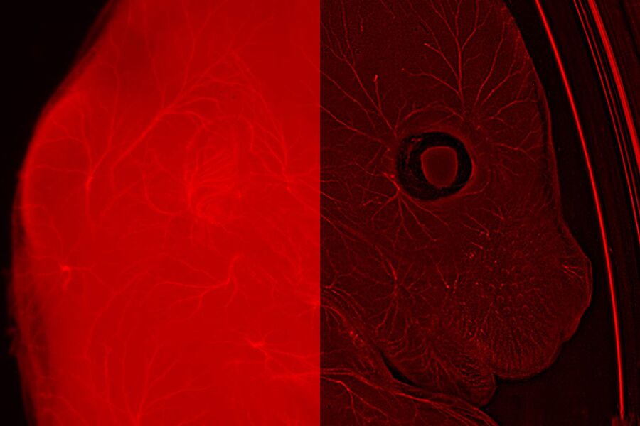 In this E12-13 muose (wt sample), neurafilaments are stained in red to assess neuronal outgrowth. The mouse was cleared with the ScaleS reagent. Sample courtesy Yves Lutz, Centre d'imagerie, IGBMC, France.