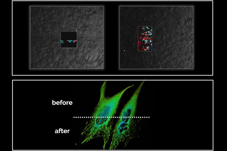 Top left: Navigation with oblique view. Top right: Navigation with Slice of Life. Bottom: SCAPE optimized computational clearing and LIGHTNING for enhancing contrast and resolution.