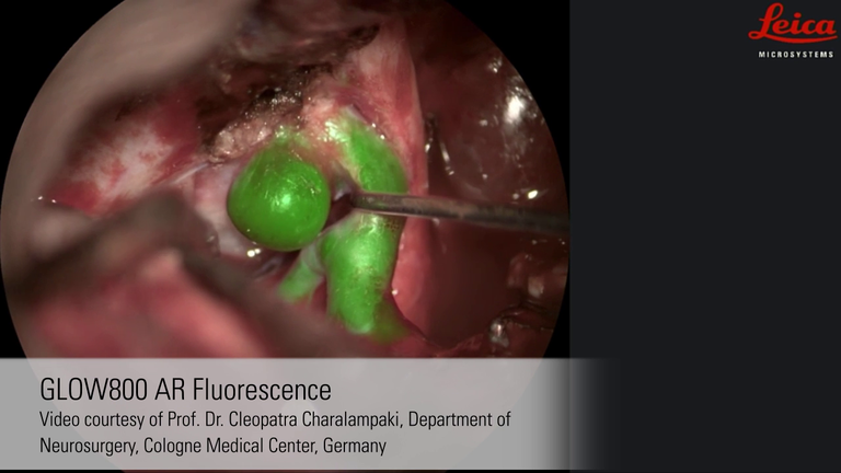 GLOW800 Augmented Reality Fluorescence Application - Media