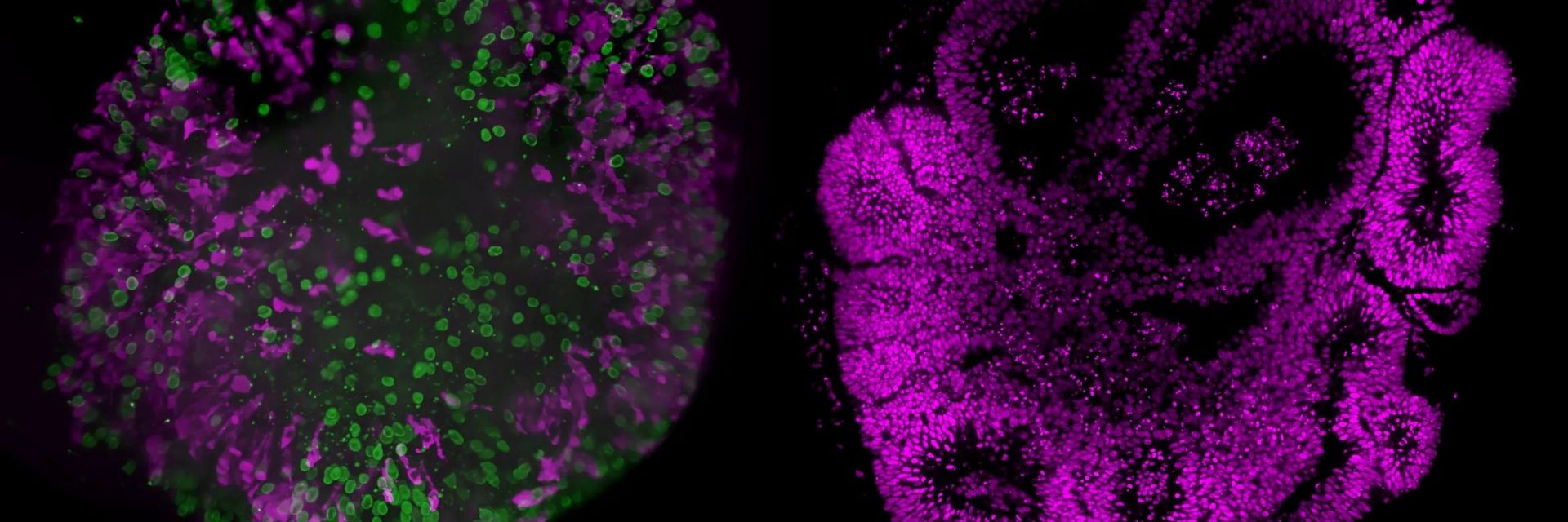Human Brain organoid