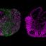 Human Brain organoid