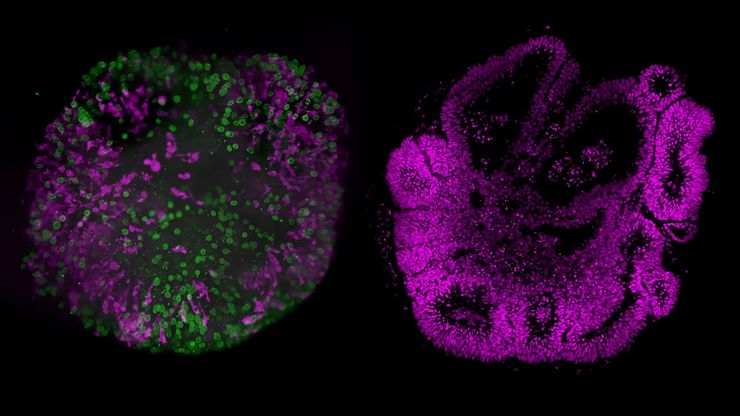 Human Brain organoid