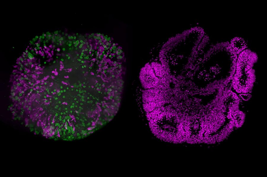 Microscopy images of a cleared and uncleared human brain organoid with different fluorescent labels, imaged using Viventis Deep.