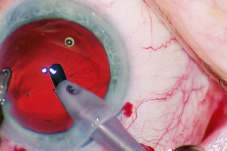Enjoy a truly bright and stable red reﬂex