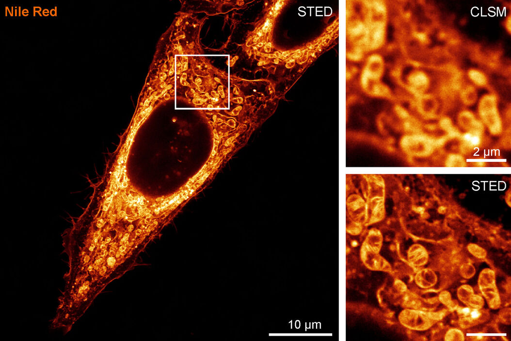  STED_Nanoscopy_fluorophore-sl.jpg