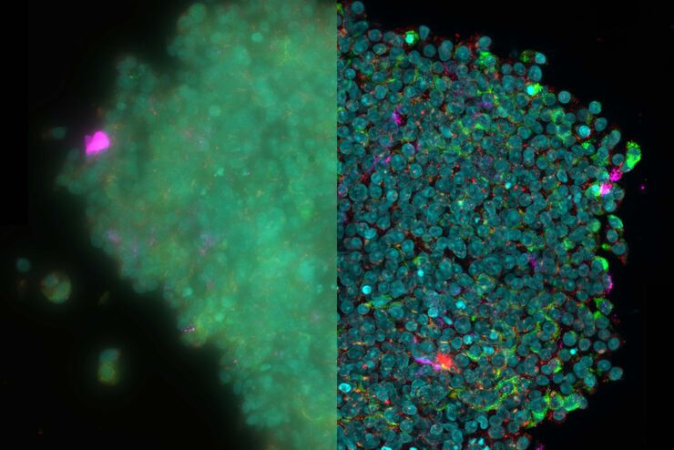 3D reconstruction of an isolated human islet 3D reconstruction of an isolated human islet