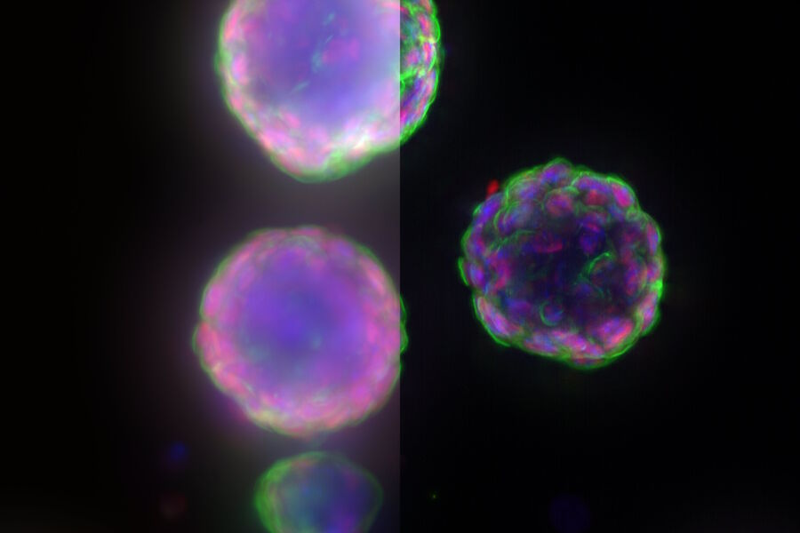 Murine esophageal organoids imaged with THUNDER Imager 3D Cell Culture. Integrin alpha6 (AlexaFluor 488, green), Sox2 (AlexaFluor 568, red), Nucleus (Dapi, blue). Sample courtesy of Dr. Fabio Tadeu Arroso Martins, Tampere University, Finland. Sample imaged by Janne Ylärinne, PhD, Immuno Diagnostic Oy.