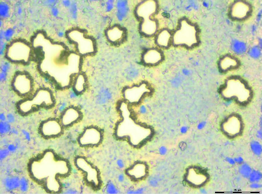 Brain section 12 μm, after dissection, objective 63x, stained with Toluidin blue. Detection of shapes by AVC+. The selected shapes are within the chosen detection criterias.