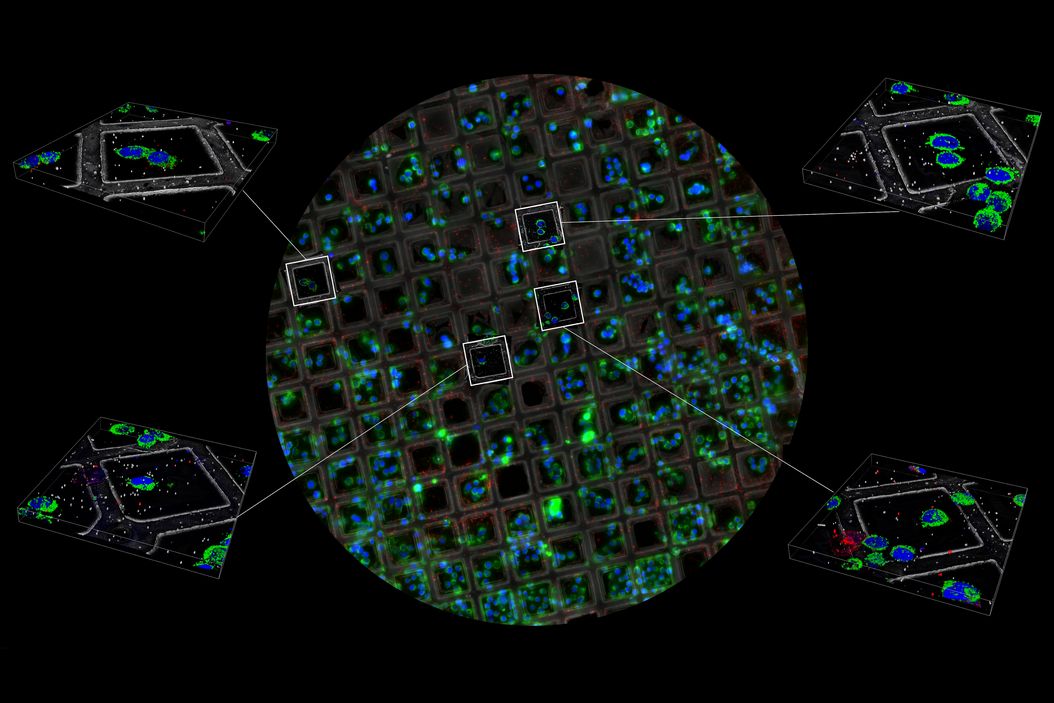Complete camera overview of EM grid recorded with 3 channels. Inserts displaying the positions, where superresolved 3D confocal images were recorded. 3D renderings of these positions are shown in the zoomed inserts. Fluorescence channels (nuclei by Hoechst, blue; mitochondria by MitoTracker Green, green; lipid Droplets by Bodipy and Crimson Beads, red). Width of a grid square is 90 ?m, width of a grid bar is 35 ?m. Samples kindly provided by Ievgeniia Zagoriy, Mahamid-Group, EMBL Heidelberg, Germany. Coral_Cryo_EM-Grid_Overview_scan_z-stacks.jpg