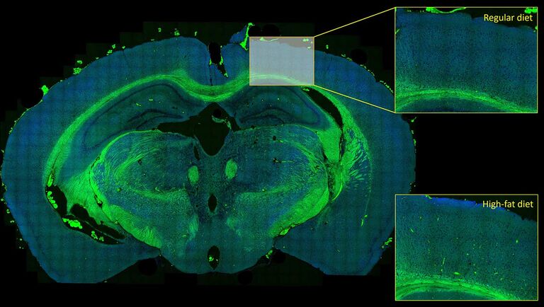 Imagerie automatisée d’échantillons de grande surface : Il s’agit ici d’un balayage de lame haute résolution d’une coupe cérébrale entière de souris. Une comparaison des régions de tissu cortical correspondantes issues de souris cultivées dans le cadre d’un régime alimentaire riche en matières grasses par rapport à un régime alimentaire normal révèle la présence de plaques artérielles pathologiques riches en lipides dans le cadre d’un régime alimentaire riche en matières grasses, mais pas dans le cadre d’un régime alimentaire régulier. Échantillon fourni avec l’aimable autorisation de Judith Leyh et Prof. Ingo Bechmann, Universität Leipzig, Allemagne.