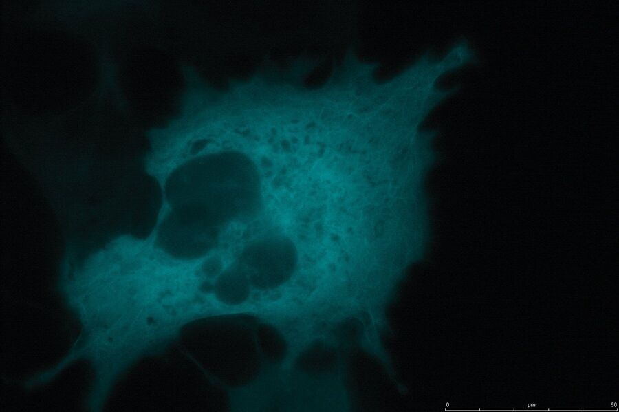 TIRF image of Galectin3 YFP