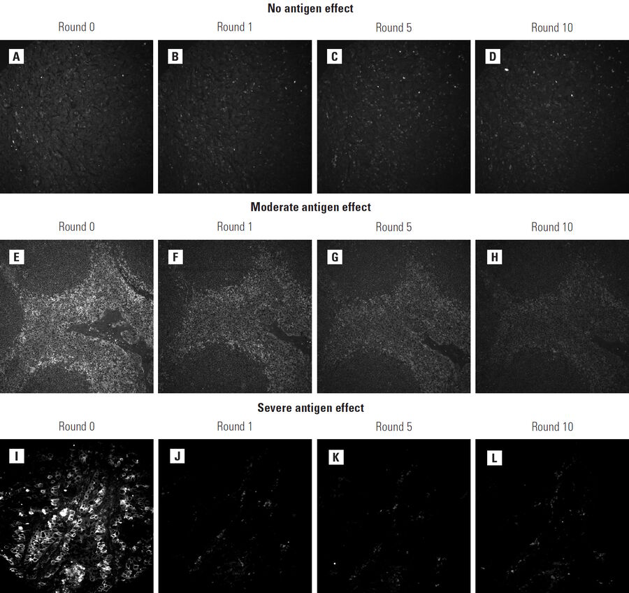 Figure 5: Three antibodies differentially affected by dye inactivation chemistry. (A-D) Breast Carcinoma stained with an antibody against CD4 shows no change in signal intensity following exposure to dye inactivation chemistry. (E-H) Tonsil tissue stained with an antibody against ribosomal protein S6 shows a small loss in signal intensity that is first notable after one round of exposure to dye-inactivation chemistry. The specificity of the staining remains intact even after 10 rounds. (I-L) Lung tissue stained with an antibody against Cytokeratin-5/6 exhibits complete loss of signal intensity after just one round. Both antibodies that exhibit antigen effects can still be used in the Cell DIVE multiplexing workflow, but should be imaged in early staining cycles.
