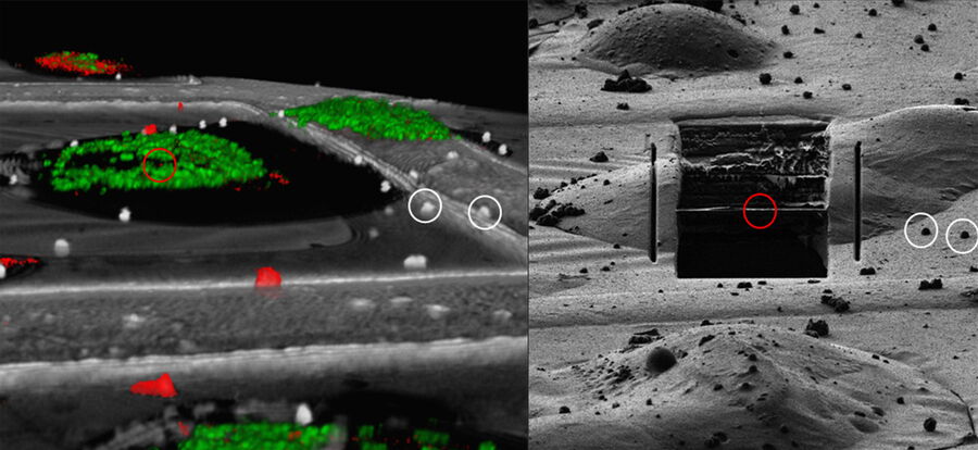 Correlation of markers in the LM and the FIB image.