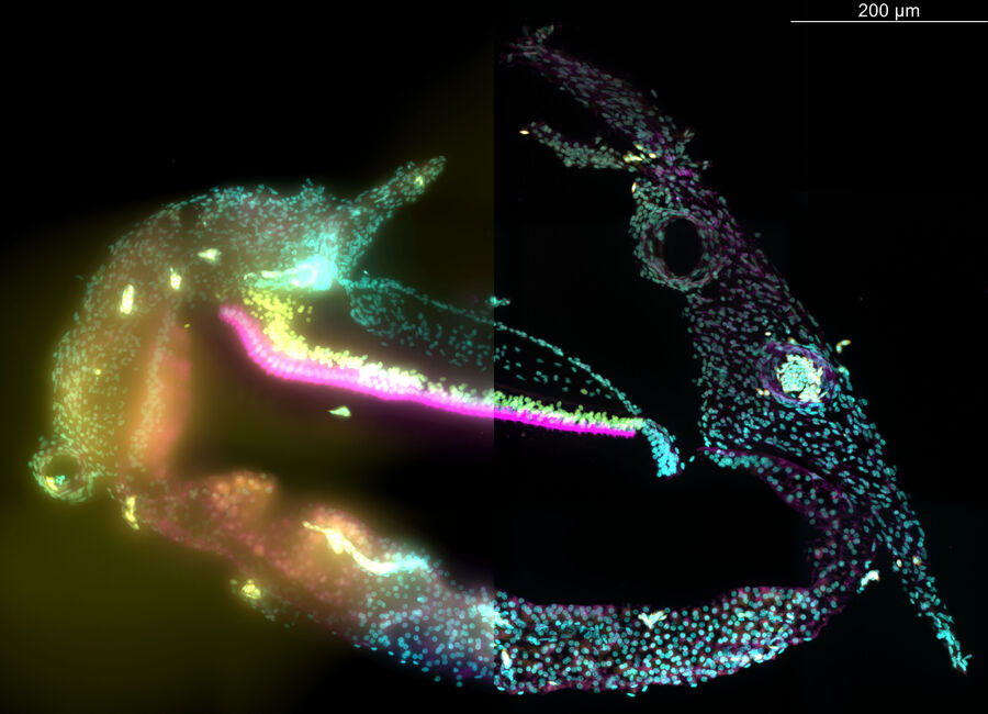 Chicken cochlea tilescan imaged on a THUNDER 3D Tissue Imager. The raw epifluorescence image is on the left, and the result of Instant Computational Clearing is on the right. This 43 µm thick vibratome section of a post-hatch day 7 chicken cochlea was stained with a nuclear DAPI stain (cyan), antibodies for Myosin 7a labeling sensory hair cells (magenta), and Sox2 labeling supporting cells (yellow). 40x oil immersion objective (NA 1.3) was used to acquire this 10-position tilescan.