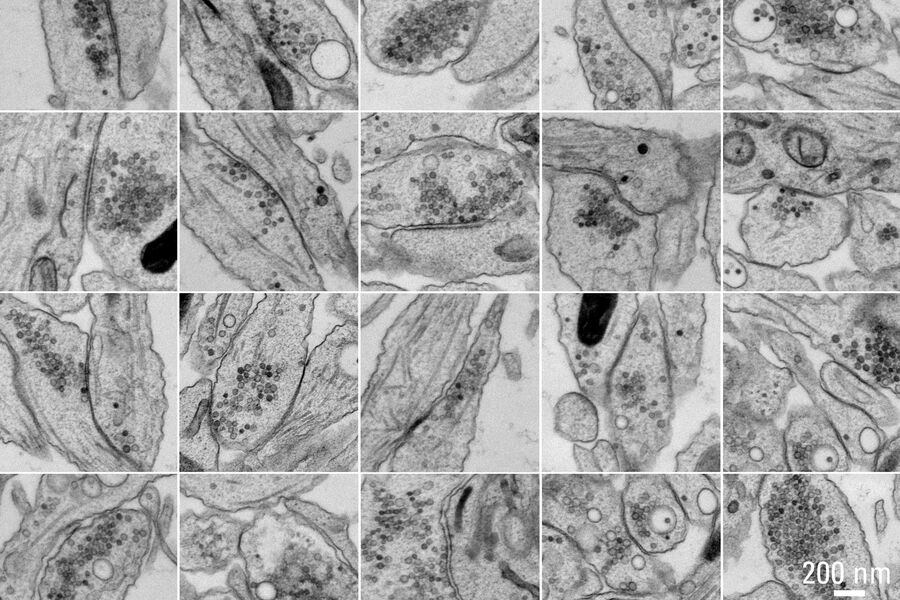 Selection of 25 synapses.