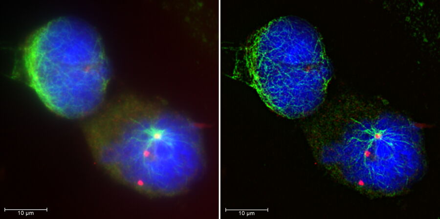 Maximum intensity projection of Ewing Sarcoma cells (SK-ES-1) 