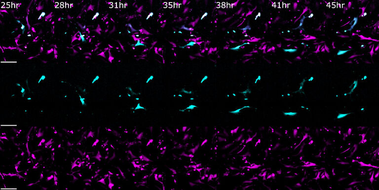 [Translate to korean:] One week cultured explants of abdominal aorta imaged for 48 hours on gelatin coated #1.5 coverglass chamber slides. The mouse was genetically encoded with a smooth muscle cell specific tdtomato. After a transcription event, the smooth muscle cells excise the tdtomato and begin to express eGFP.
