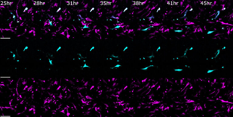 Time-Lapse-Aufnahme eines Explantats Eine Woche kultivierte Explantate der abdominalen Aorta, die 48 Stunden lang auf mit Gelatine beschichteten #1.5 Deckglas-Kammerobjektträgern abgebildet wurden. Die Maus wurde genetisch für ein spezifisch in glatten Muskelzellen exprimiertes tdTomato kodiert. Nach einem spezifischen Transkriptionsereignis schneiden die glatten Muskelzellen tdTomato aus und beginnen, eGFP zu exprimieren.