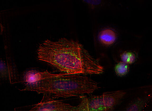 HeLa-Zellen mit THUNDER Imager