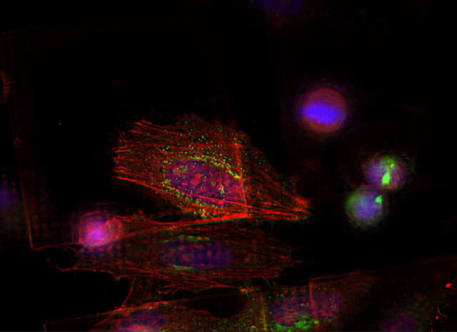 Cellule HeLa con THUNDER Imager Cellule HeLa con THUNDER Imager