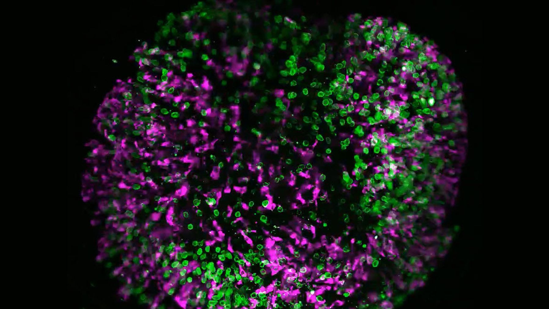 Brain organoid labeled with lamin (green) and tubulin (magenta), acquired using Viventis Deep. Courtesy of Akanksha Jain, Treutlein Lab ETH-DBSSE Basel (Switzerland).