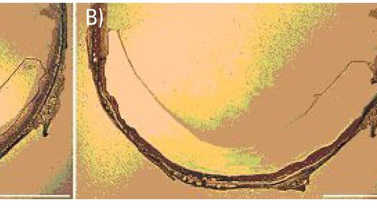 Laser capture microdissection of adult mouse retinal layers. Laser capture microdissection of adult mouse retinal layers.