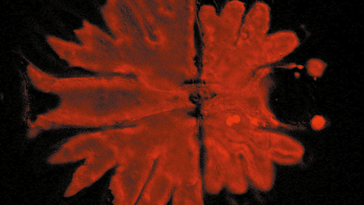Phase Contrast Color Camera A Guide to Phase Contrast | Learn & Share | Leica Microsystems