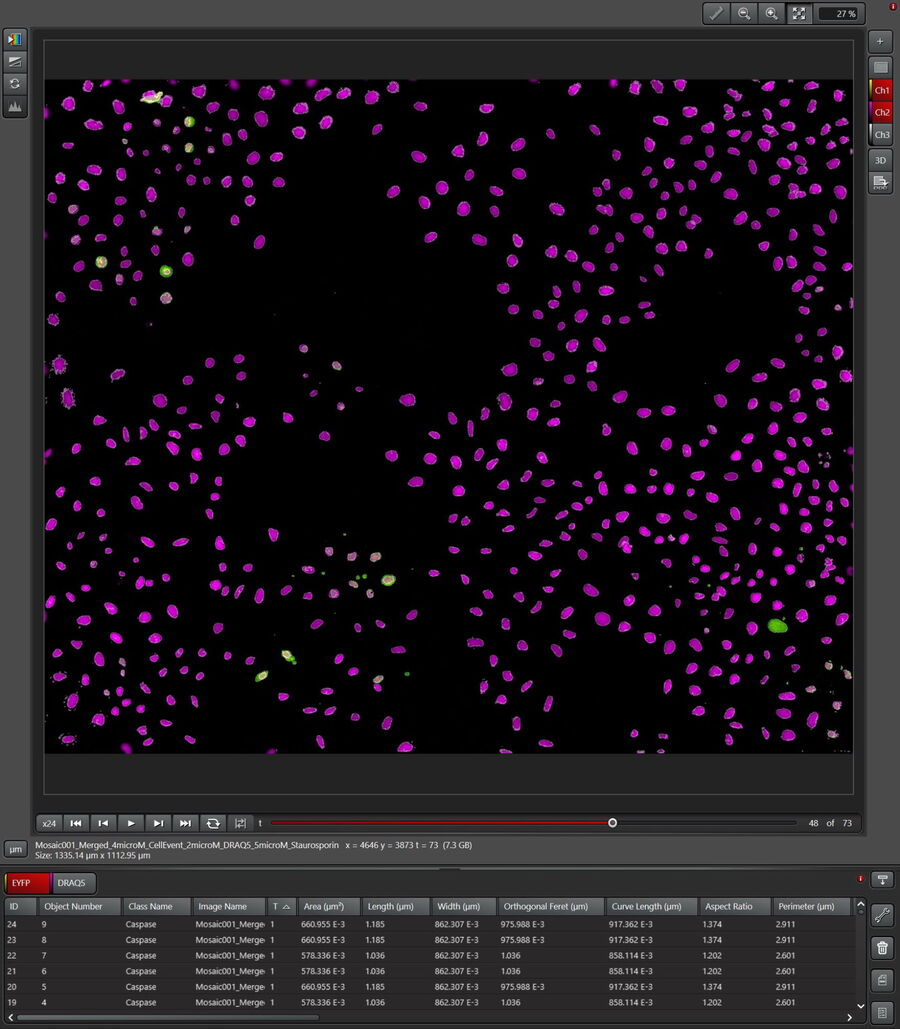 Apoptosis DRAQ5; Caspase Count; Pixel Classifier