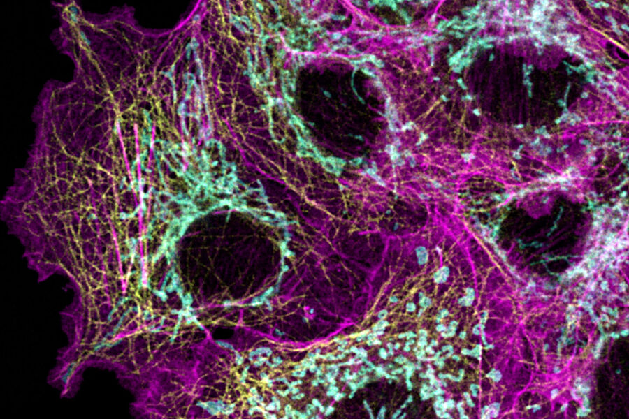 Mitotic COS7 Cells: SiR-Actin (ex: 647 nm, em: 657-740 nm), AF750-Tom20 (ex: 750 nm, em: 760-790 nm), and AF790-memb (ex: 790 nm, em: 810-850 nm). Sample courtesy of Jana Döhner and Urs Ziegler, University of Zurich, Switzerland. Image acquired with STELLARIS.