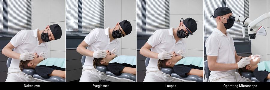 The Magniﬁcation Continuum showing the dentist working via the naked eye on the far left to eyeglasses, dental loupes, and finally the operating microscope on the far right. For the microscope case, note the improved posture (more neutral and balanced) of the dentist thanks to the longer working distance of the microscope, even with increasing levels of magniﬁcation.