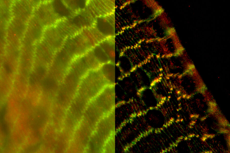 This slide is a transversal Mouse adult lens section showing the fiber lens cells organization (green, stained with anti-β-catenin antibody (BDB610153), a membrane protein) and Afadin (red, stained with anti-Afadin (PA1-25076), an actin filament-binding protein, blue, Hoechst). Image courtesy of Dr. Nathalie Houssin, Plagemen Lab, Ohio State University, USA.