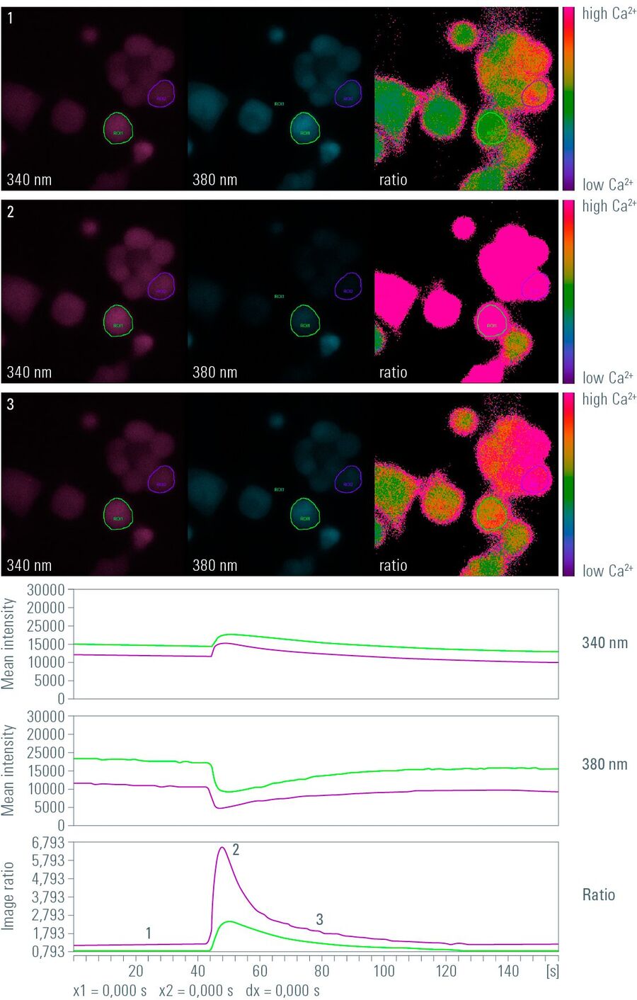 Snapshots from a time lapse of a calcium imaging experiment using the ratiometric calcium indicator Fura-2.