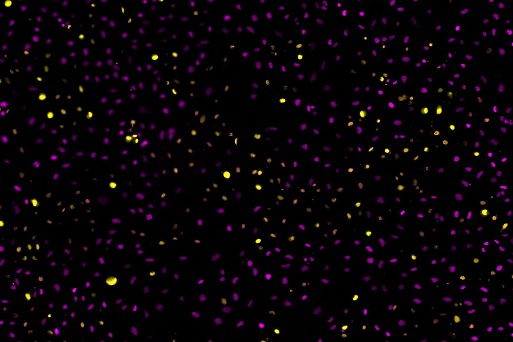 Two-color caspase assay with tile scan. U2OS cells were treated with the nuclear marker DRAQ5 (magenta) and CellEvent™ (yellow). Two-color_caspase_assay_with_tile_scan.jpg