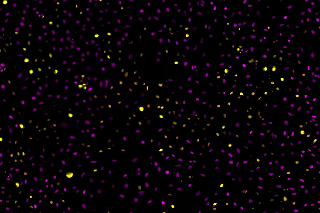 Two-color caspase assay with tile scan. U2OS cells were treated with the nuclear marker DRAQ5 (magenta) and CellEvent™ (yellow). Two-color_caspase_assay_with_tile_scan.jpg