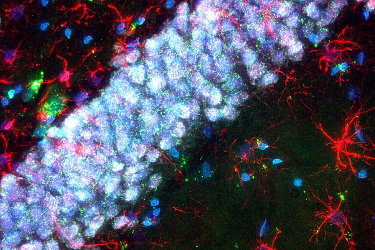 La figura mostra un'immagine acquisita con la fotocamera Scientific CMOS K8 integrata in THUNDER del cervello di ratto colorato con DAPI (Blue), fluoresceina STL (Verde), GFAP- Cy3 (Rosso) e Neun Cy5 (Grigio). Campione fornito da FAN GmbH.