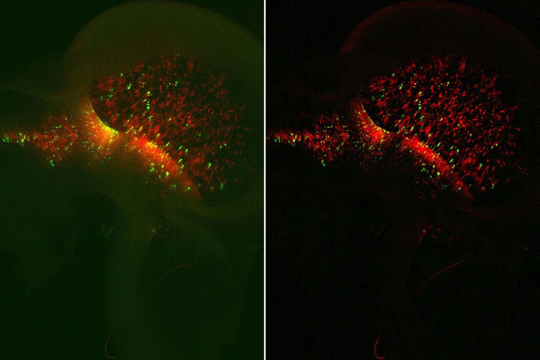  Chick_embryo_brain_mScarlet_RFP_sonic-hedgehog-regulated_EGFP_indicating_neuronal_progenitors_teaser_01.jpg