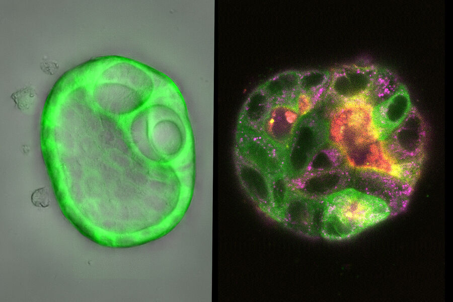Cyst formed by MDCK cells Cyst formed by MDCK cells