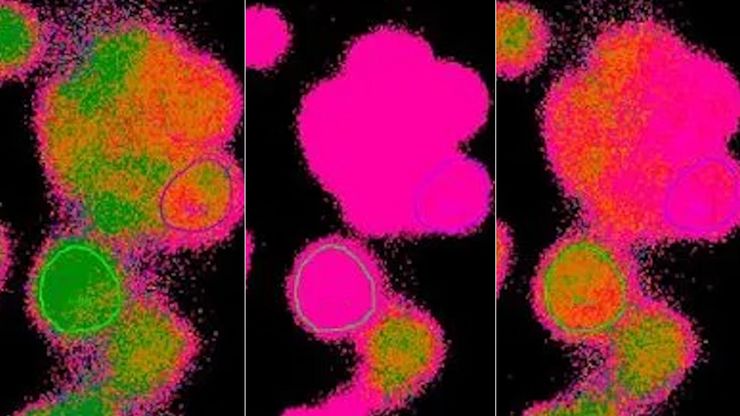 Time-lapse imaging of calcium in cells using the ratiometric calcium indicator Fura-2.