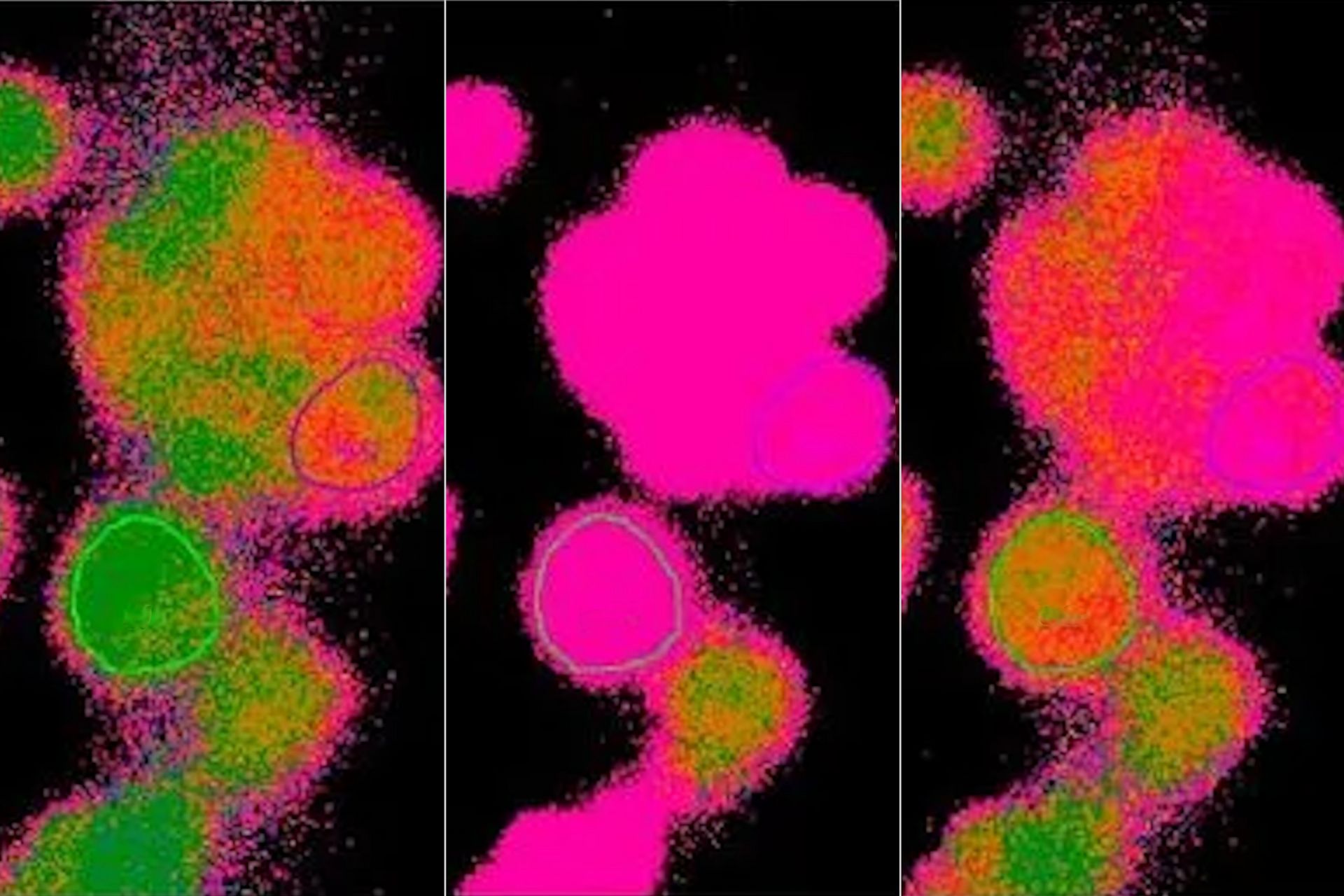 Time-lapse imaging of calcium in cells using the ratiometric calcium indicator Fura-2.